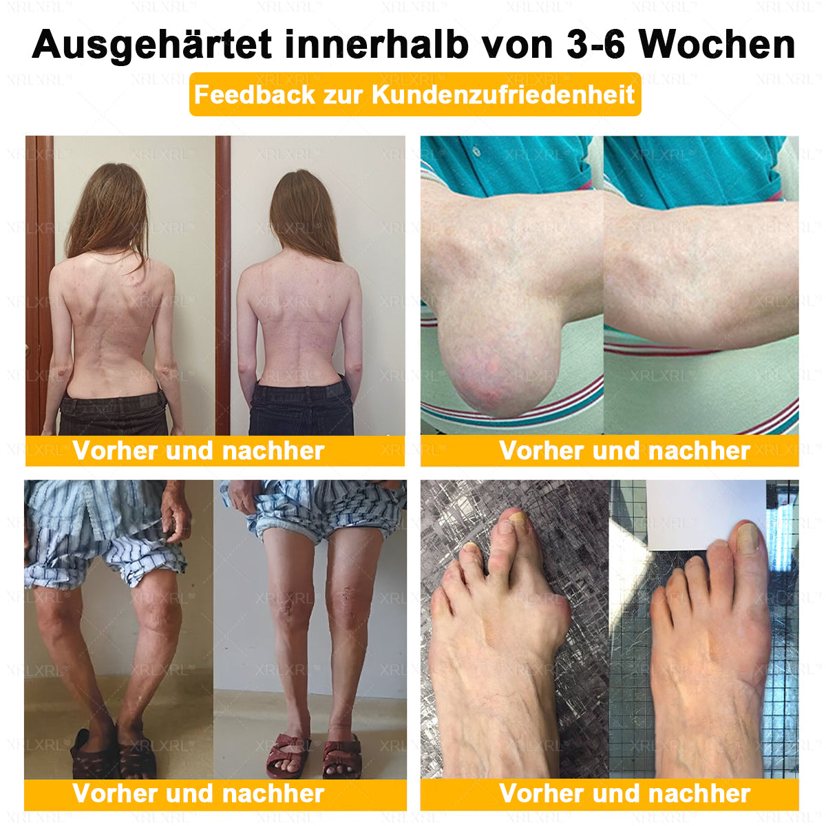 XRLXRL®🎁🎁🎁Letzte Chance! Sichern Sie sich dieses Glücksangebot mit 50% Rabatt!