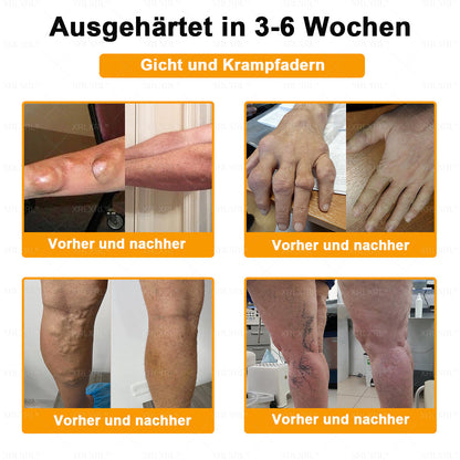 XRLXRL®🎁🎁🎁Letzte Chance! Sichern Sie sich dieses Glücksangebot mit 50% Rabatt!