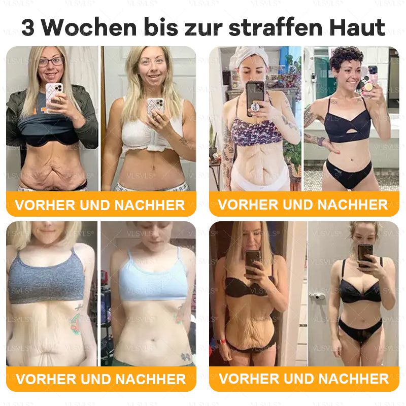 Hergestellt und versendet aus Deutschland  🧑‍⚕️🧑‍⚕️VLSVLS® Bienengift Hautregenerationscreme LETZTER TAG 80 % RABATT