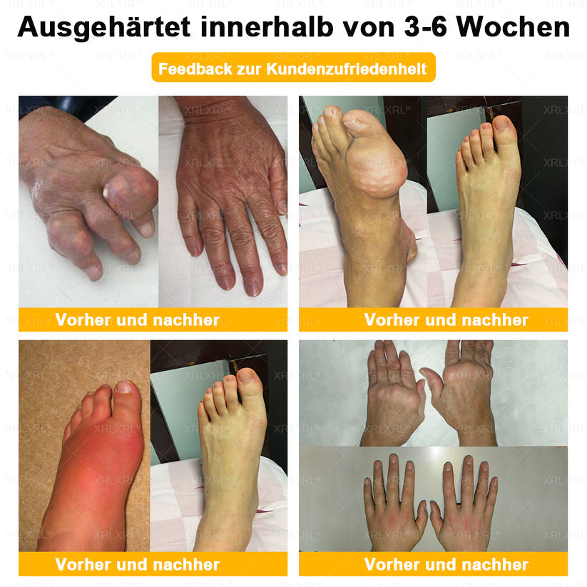XRLXRL®🎁🎁🎁Letzte Chance! Sichern Sie sich dieses Glücksangebot mit 50% Rabatt!