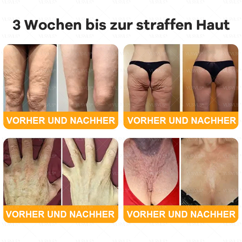 Hergestellt und versendet aus Deutschland  🧑‍⚕️🧑‍⚕️VLSVLS® Bienengift Hautregenerationscreme LETZTER TAG 80 % RABATT