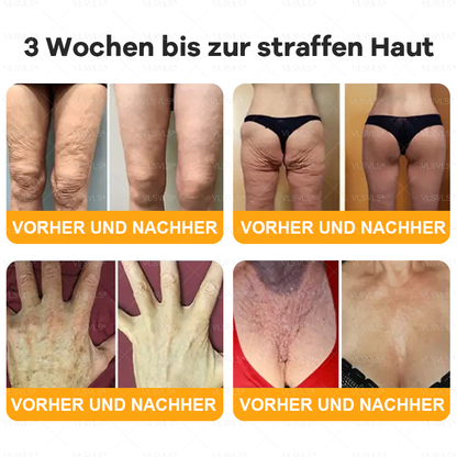 Hergestellt und versendet aus Deutschland  🧑‍⚕️🧑‍⚕️VLSVLS® Bienengift Hautregenerationscreme LETZTER TAG 80 % RABATT