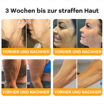 Hergestellt und versendet aus Deutschland  🧑‍⚕️🧑‍⚕️VLSVLS® Bienengift Hautregenerationscreme LETZTER TAG 80 % RABATT