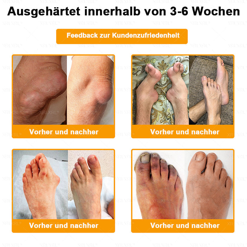 XRLXRL®🎁🎁🎁Letzte Chance! Sichern Sie sich dieses Glücksangebot mit 50% Rabatt!