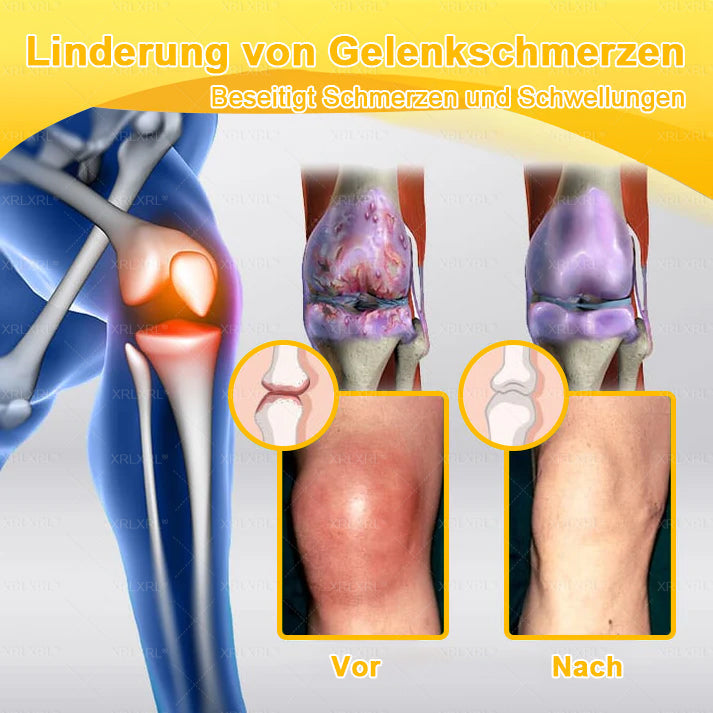 XRLXRL®🎁🎁🎁Letzte Chance! Sichern Sie sich dieses Glücksangebot mit 50% Rabatt!